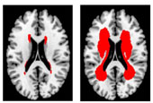 Researchers develop world’s 1st brain map